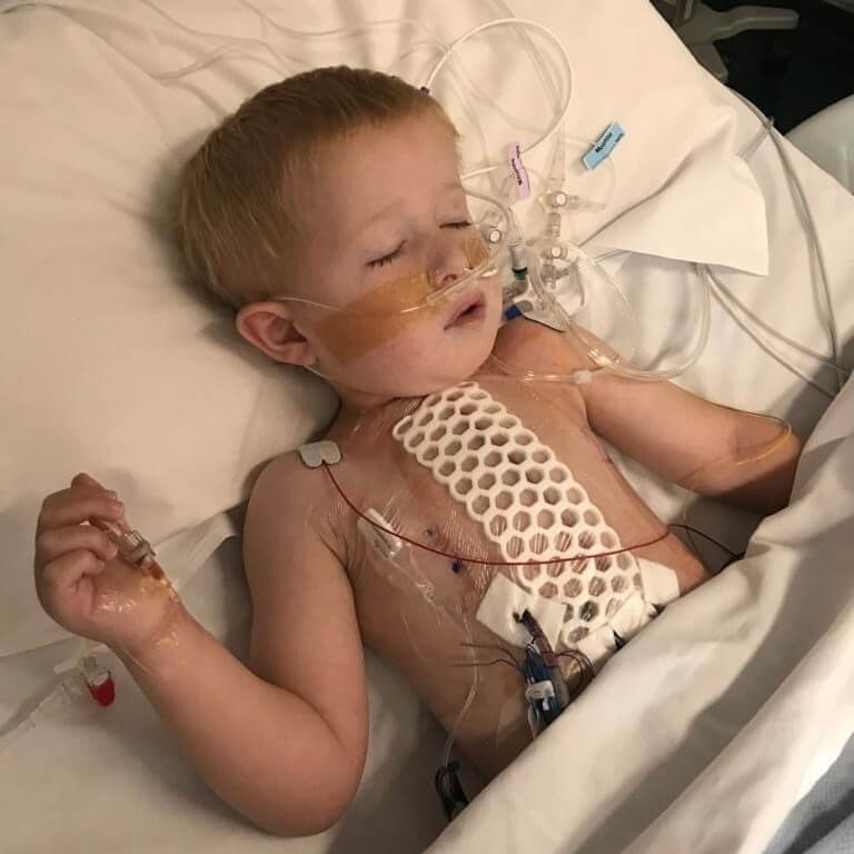 Finley asleep in a hospital bed with breathing tubes and monitoring cables attached