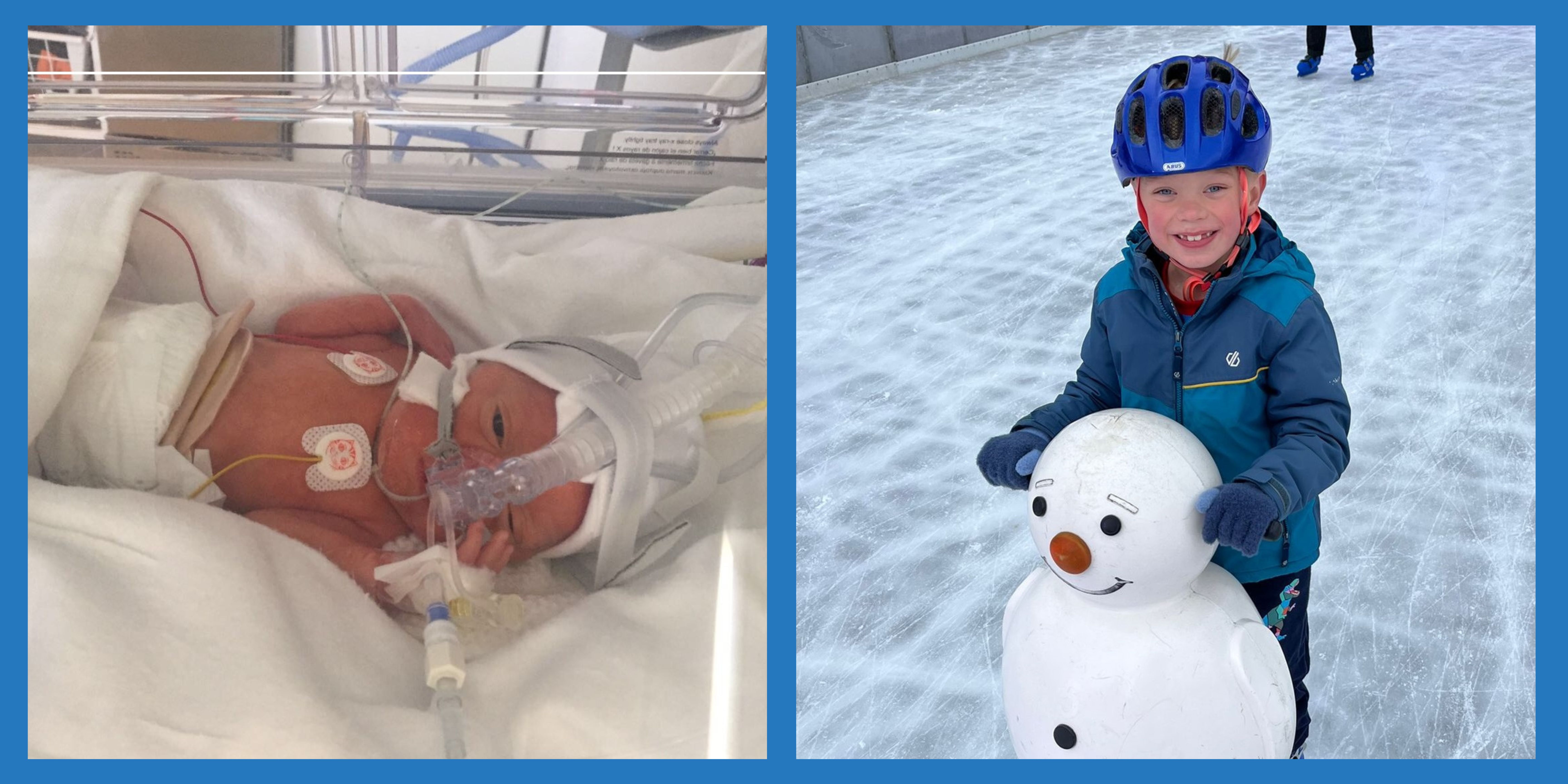 Appeal star Wilfred, shown in care in the Neonatal Intensive Care Unit, and also now 7 years old enjoying ice skating.