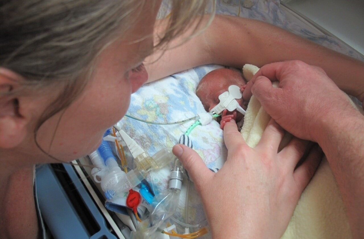 Baby Jago in intensive care