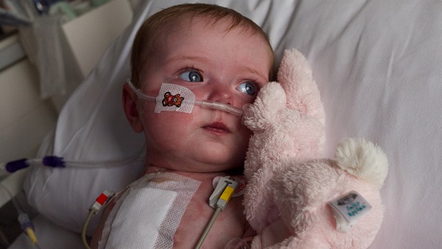 Baby girl in hospital following heart surgery with a wound dressing on her chest.