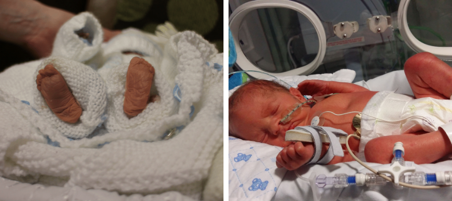 On the left, an image of Oscar's feet shortly after he was born sleeping. On the right, Felix lying in an incubator