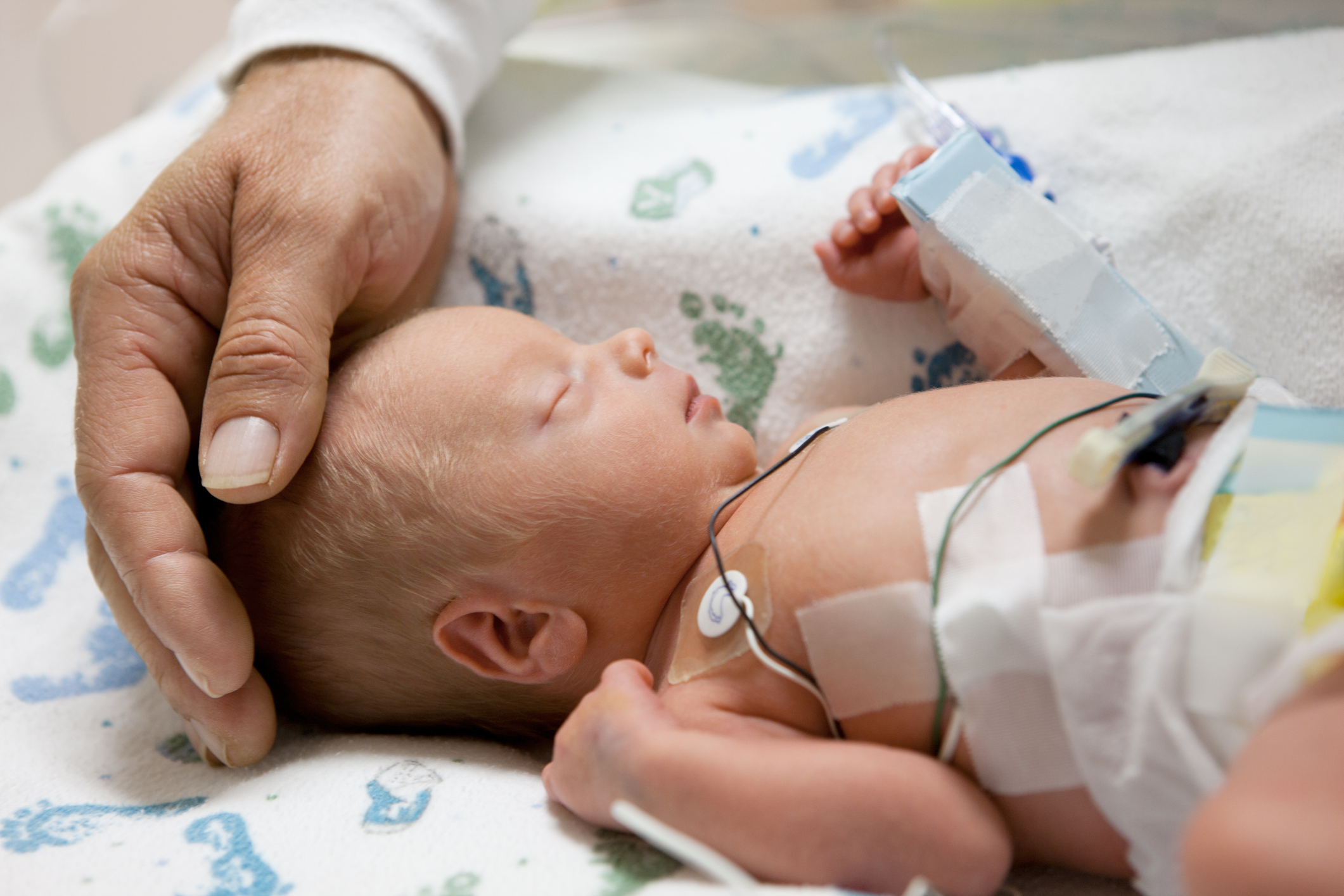 Premature infant under hospital care