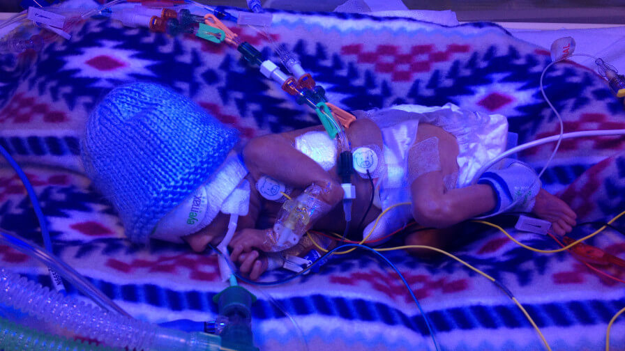 Small baby with NEC in incubator