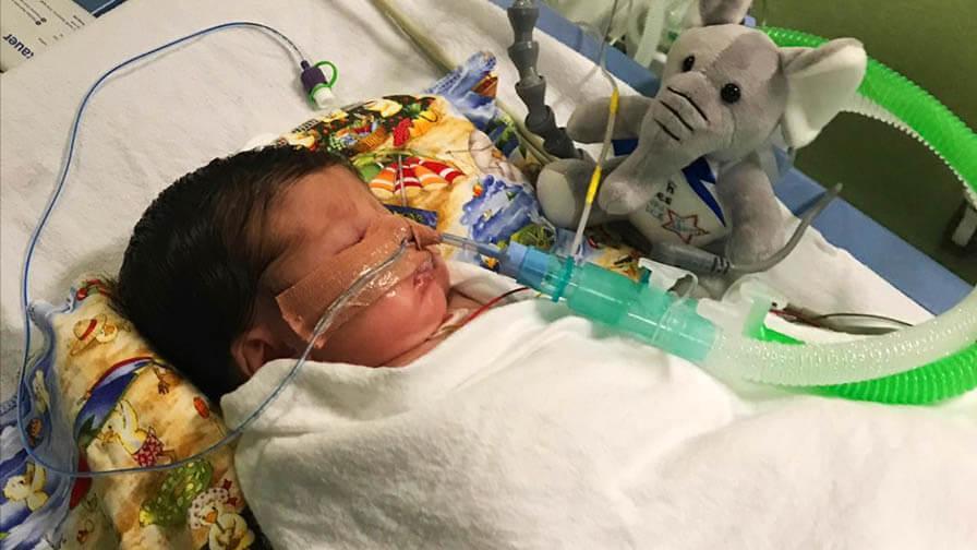 baby ella in hospital bed on ventilator