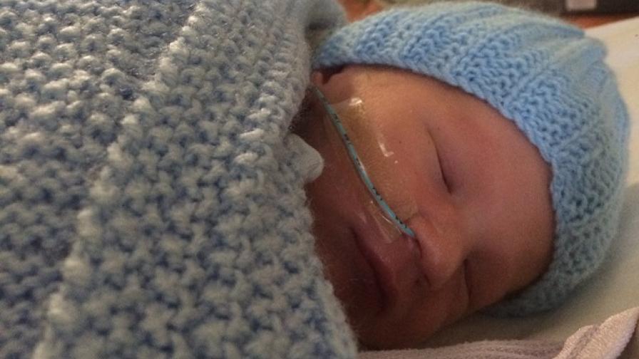 Mylo as a baby in his hospital incubator.