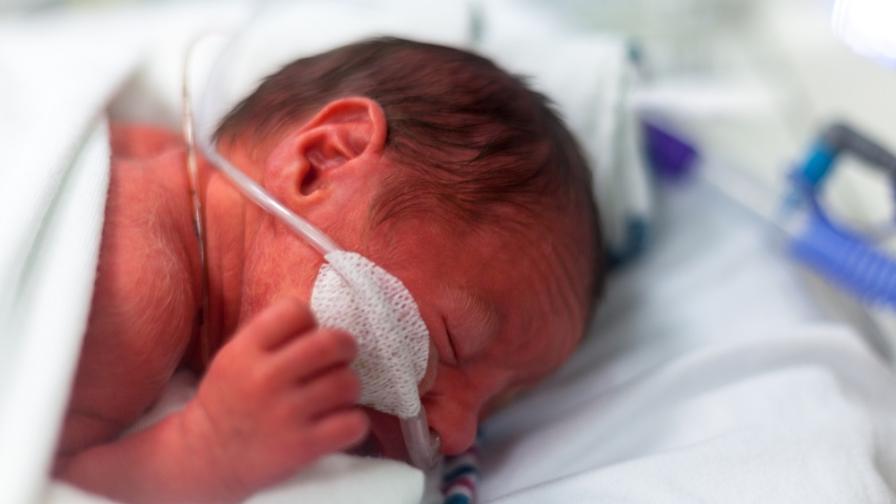 Premature baby with breathing tube