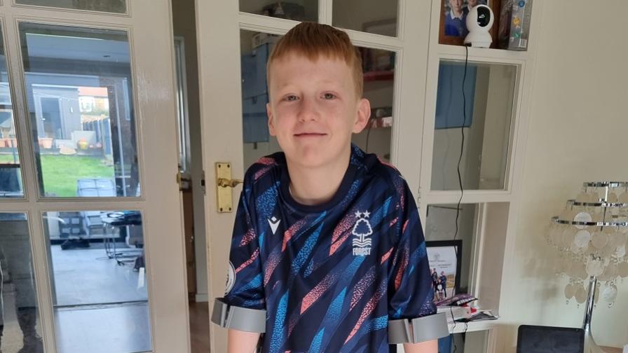 Oscar, who has neurofibromatosis type 2. He is wearing a Nottingham Forest football shirt.
