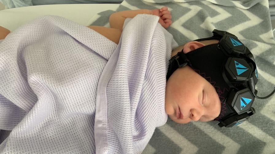 A baby laying asleep in a hospital cot, with a special imaging cap on their head to monitor blood flow in the brain.