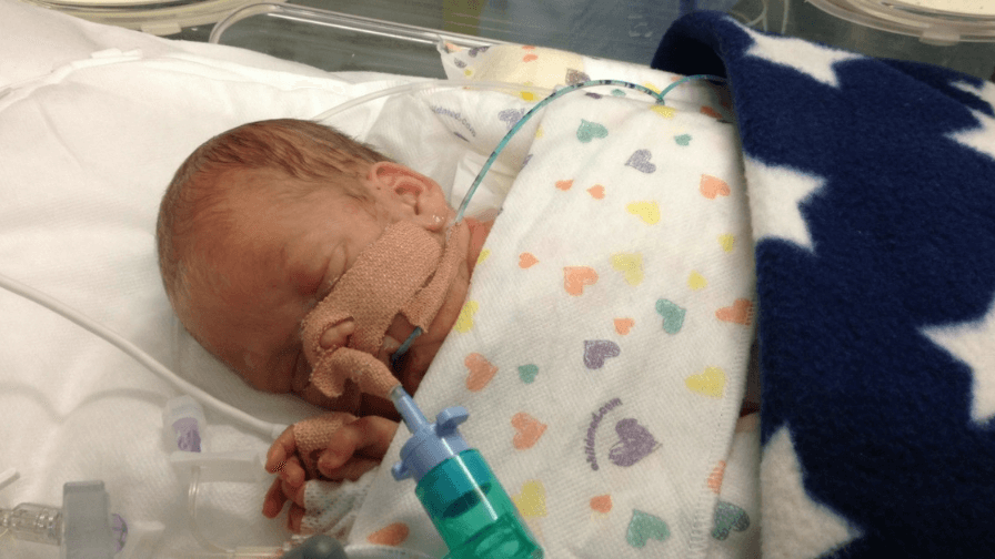 jack in the neo natal unit