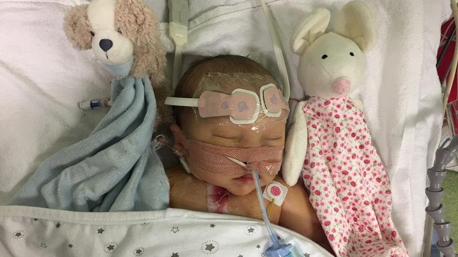 Baby Hattie sleeping in a hospital bed in intensive care following surgery. A breathing tube is taped across her face and a monitoring sensor on the forehead. Two stuffed animal comfort toys, a dog and bunny, are on either side.