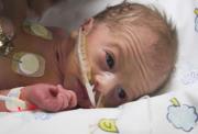 Baby in an incubator with breathing tubes