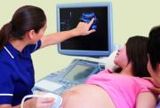 Pregnant lady receiving a ultrasound scan