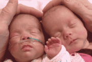 Two babies born premature with breathing tubes