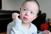 Jack, a child with Down syndrome