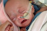 A photo of a very young baby sleeping, with a tube feeding into their nose to help them breathe.