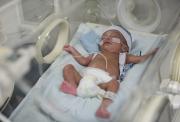 Image shows a premature baby boy in a hospital incubator, with several tubes attached.
