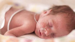 Small baby with oxygen tubes