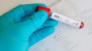 CMV blood test vile