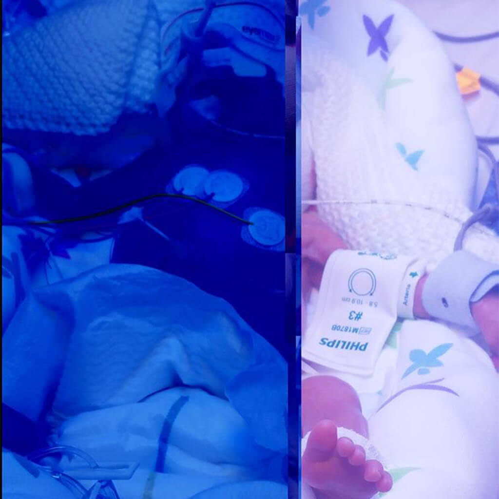New born baby in an incubator with breathing tubes and monitoring wires